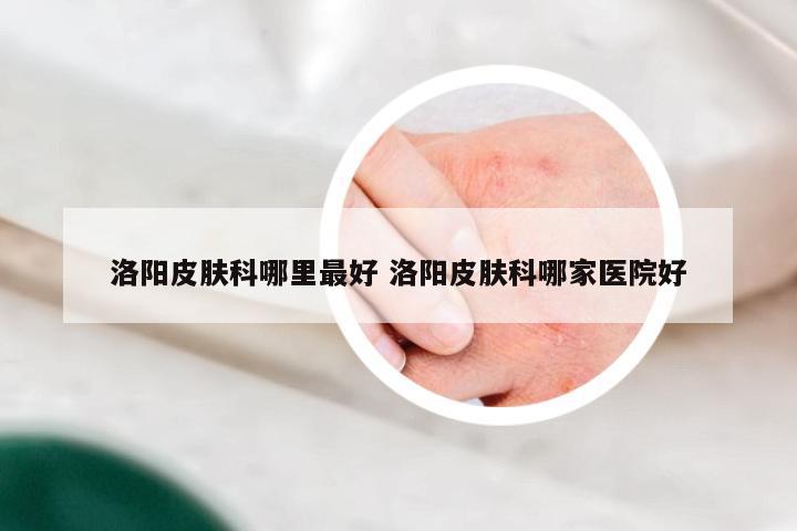 洛阳皮肤科哪里最好 洛阳皮肤科哪家医院好