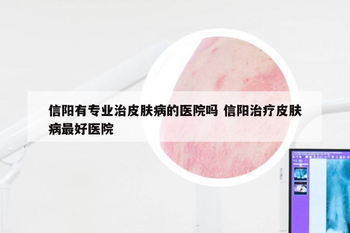 信阳有专业治皮肤病的医院吗 信阳治疗皮肤病最好医院