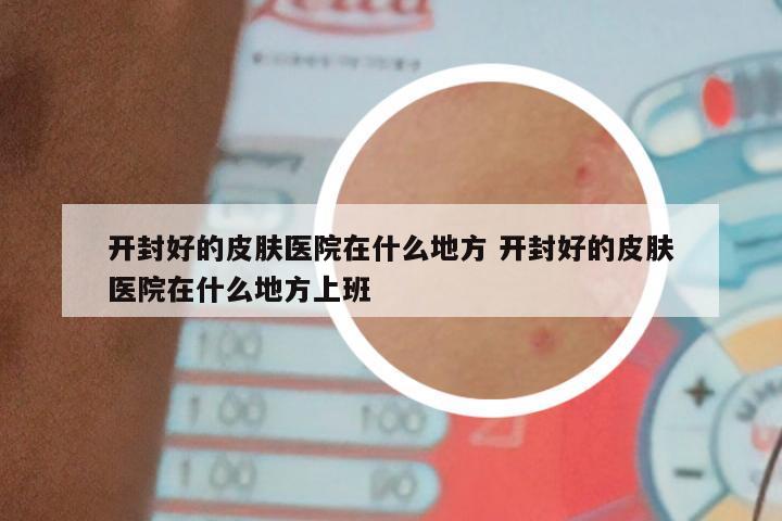 开封好的皮肤医院在什么地方 开封好的皮肤医院在什么地方上班