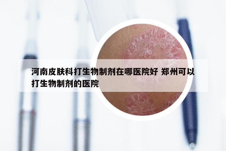 河南皮肤科打生物制剂在哪医院好 郑州可以打生物制剂的医院