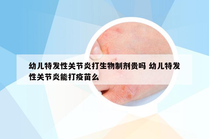 幼儿特发性关节炎打生物制剂贵吗 幼儿特发性关节炎能打疫苗么