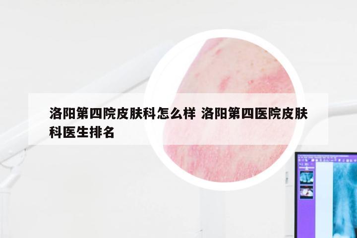 洛阳第四院皮肤科怎么样 洛阳第四医院皮肤科医生排名