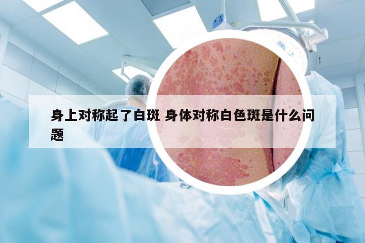 身上对称起了白斑 身体对称白色斑是什么问题