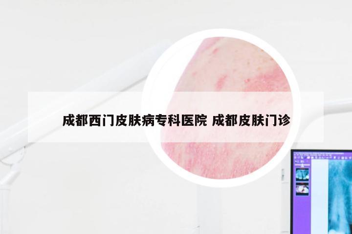 成都西门皮肤病专科医院 成都皮肤门诊