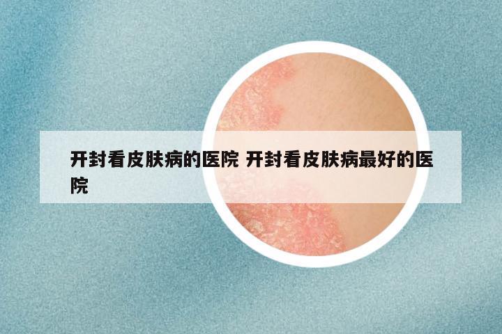 开封看皮肤病的医院 开封看皮肤病最好的医院