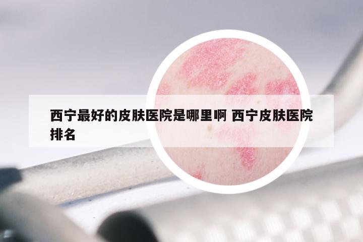 西宁最好的皮肤医院是哪里啊 西宁皮肤医院排名