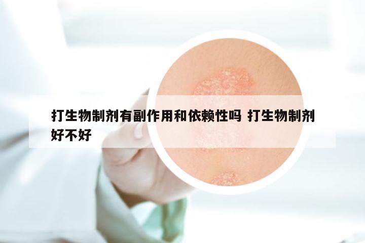 打生物制剂有副作用和依赖性吗 打生物制剂好不好