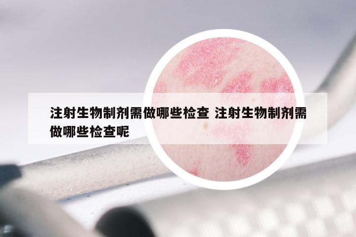 注射生物制剂需做哪些检查 注射生物制剂需做哪些检查呢