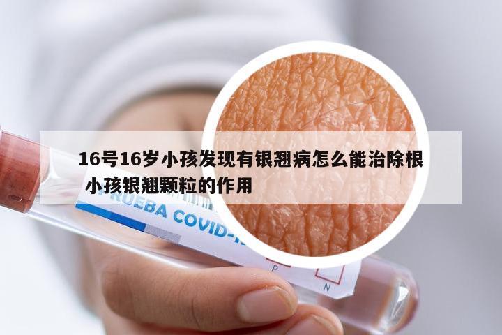16号16岁小孩发现有银翘病怎么能治除根 小孩银翘颗粒的作用
