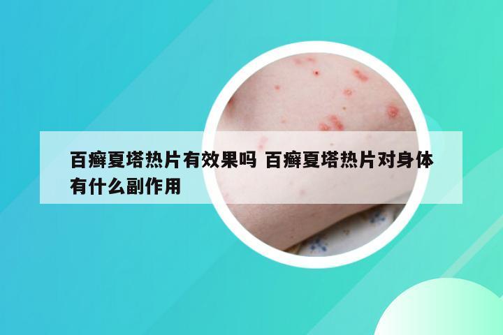 百癣夏塔热片有效果吗 百癣夏塔热片对身体有什么副作用