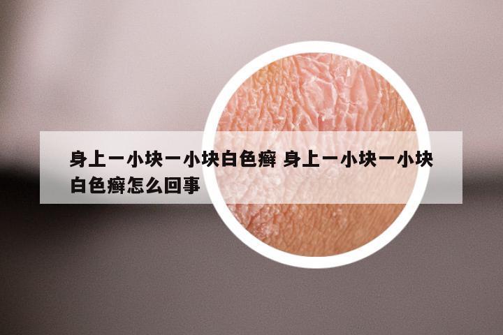 身上一小块一小块白色癣 身上一小块一小块白色癣怎么回事
