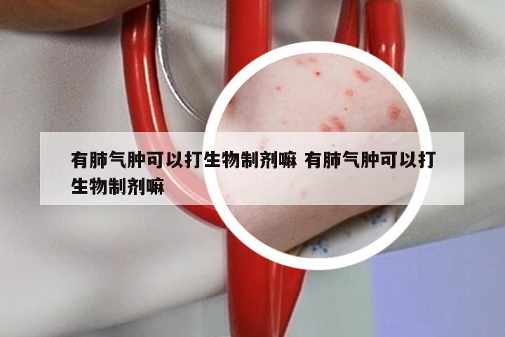 有肺气肿可以打生物制剂嘛 有肺气肿可以打生物制剂嘛