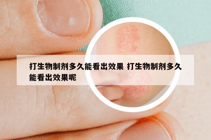 打生物制剂多久能看出效果 打生物制剂多久能看出效果呢