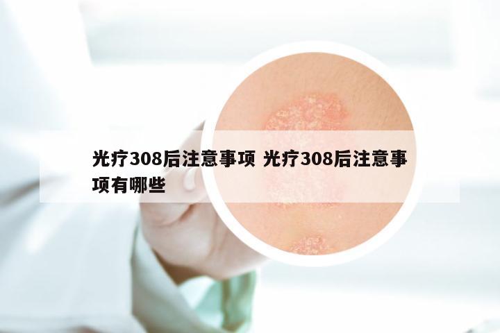 光疗308后注意事项 光疗308后注意事项有哪些