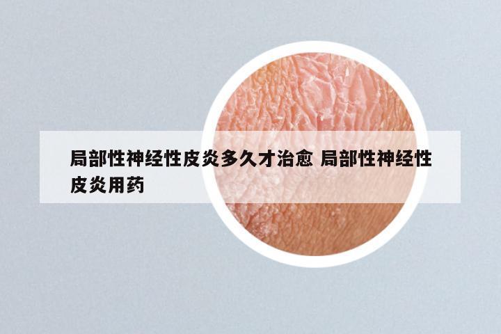 局部性神经性皮炎多久才治愈 局部性神经性皮炎用药