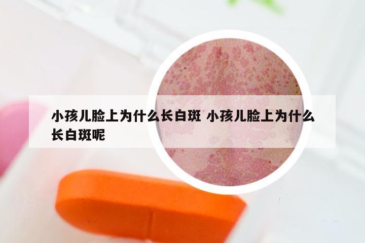 小孩儿脸上为什么长白斑 小孩儿脸上为什么长白斑呢