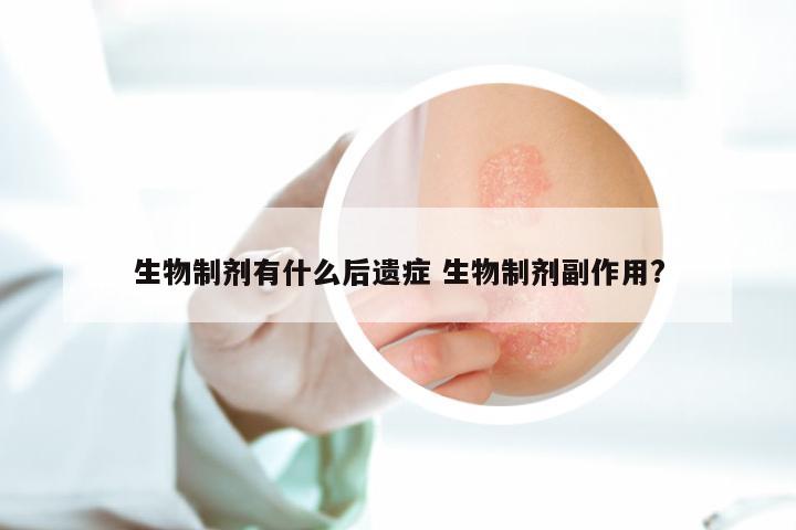生物制剂有什么后遗症 生物制剂副作用?