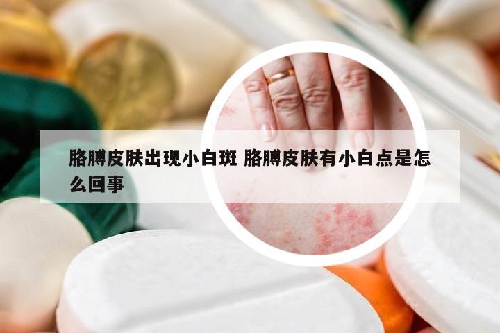 胳膊皮肤出现小白斑 胳膊皮肤有小白点是怎么回事
