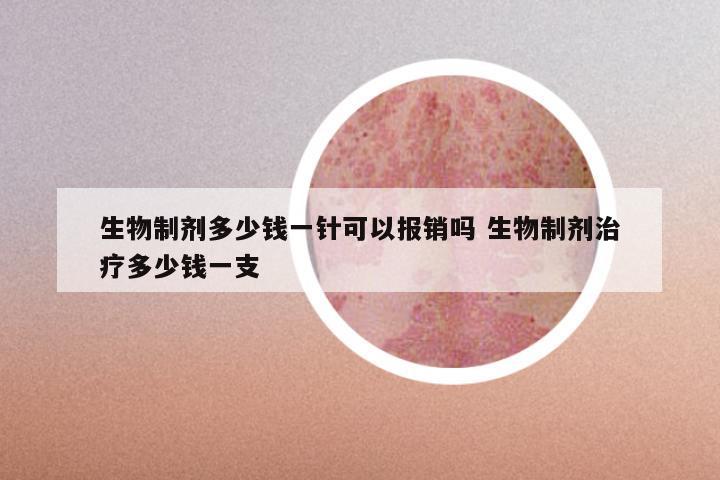生物制剂多少钱一针可以报销吗 生物制剂治疗多少钱一支