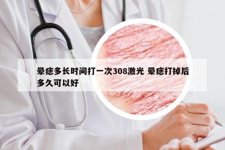 晕痣多长时间打一次308激光 晕痣打掉后多久可以好