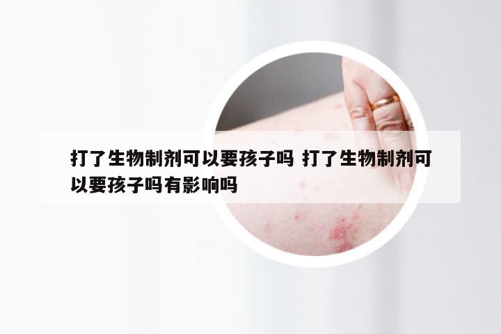 打了生物制剂可以要孩子吗 打了生物制剂可以要孩子吗有影响吗