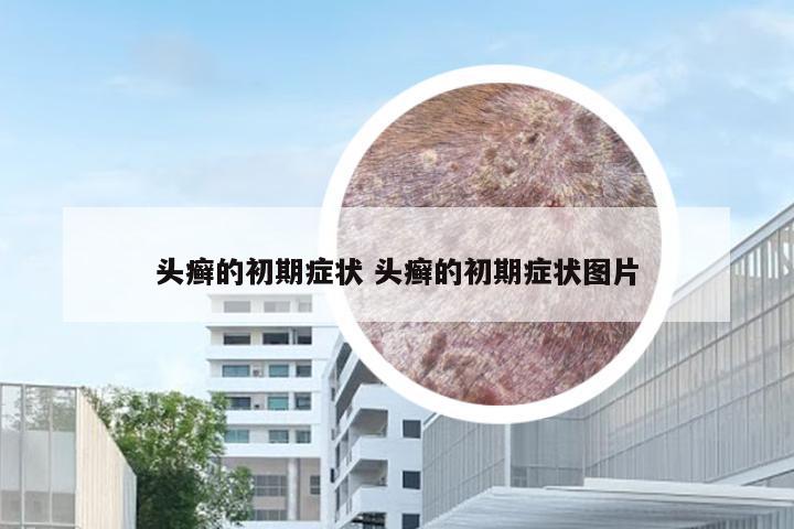 头癣的初期症状 头癣的初期症状图片