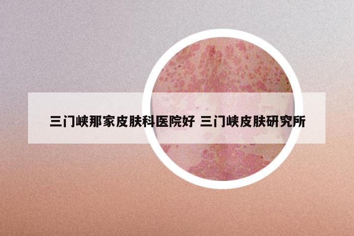 三门峡那家皮肤科医院好 三门峡皮肤研究所
