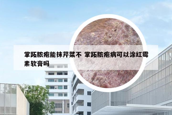 掌跖脓疱能抹芹菜不 掌跖脓疱病可以涂红霉素软膏吗