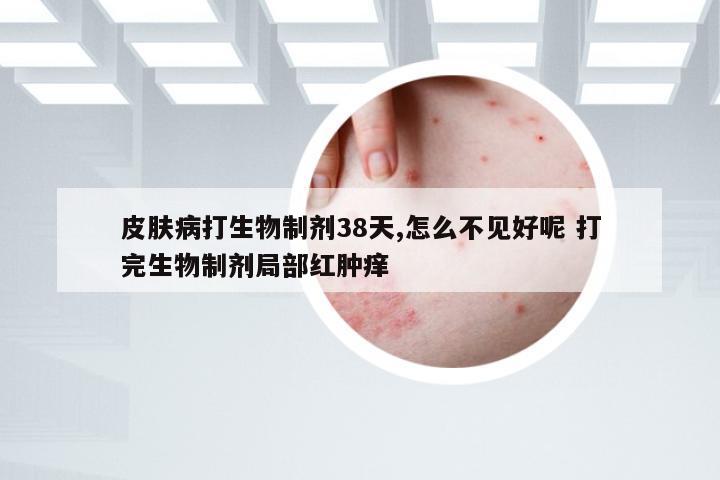 皮肤病打生物制剂38天,怎么不见好呢 打完生物制剂局部红肿痒