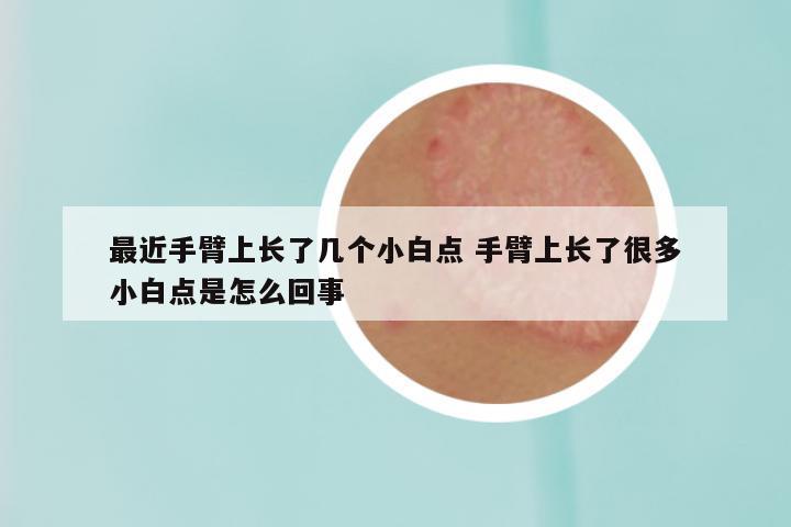 最近手臂上长了几个小白点 手臂上长了很多小白点是怎么回事