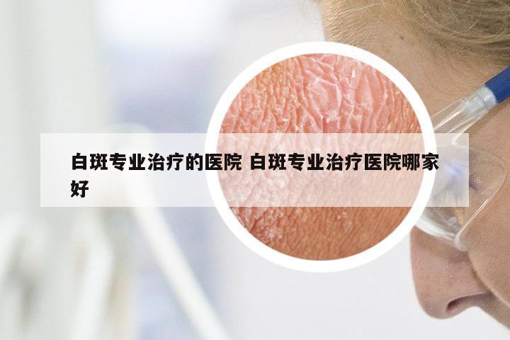 白斑专业治疗的医院 白斑专业治疗医院哪家好