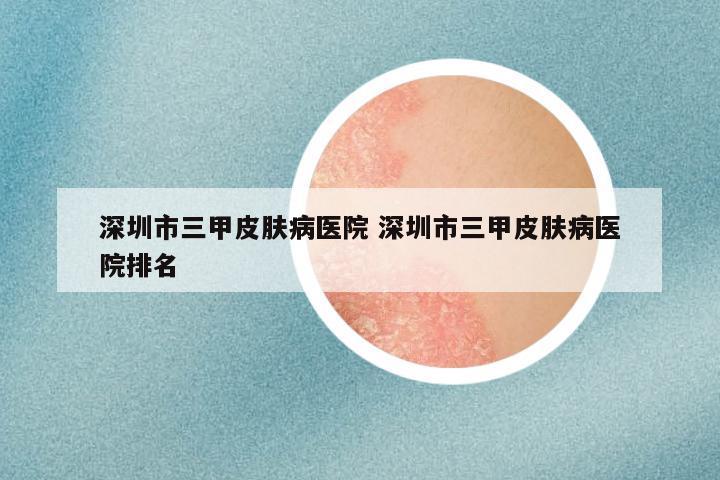 深圳市三甲皮肤病医院 深圳市三甲皮肤病医院排名