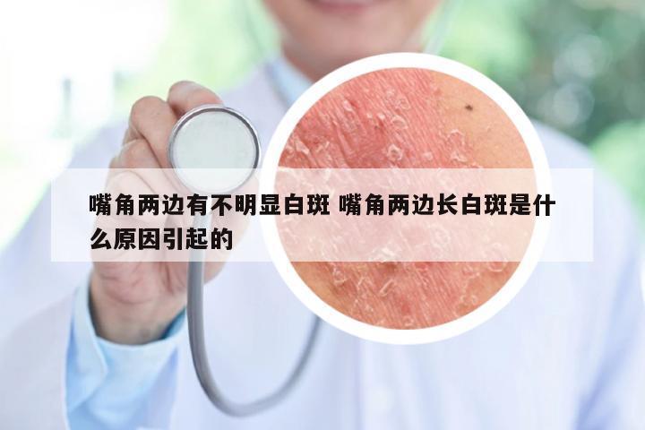嘴角两边有不明显白斑 嘴角两边长白斑是什么原因引起的