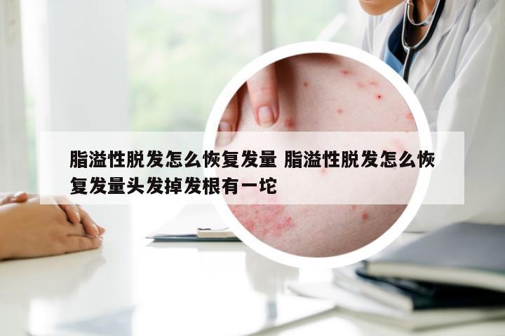 脂溢性脱发怎么恢复发量 脂溢性脱发怎么恢复发量头发掉发根有一坨