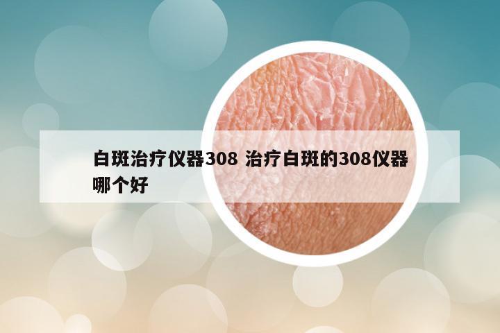 白斑治疗仪器308 治疗白斑的308仪器哪个好