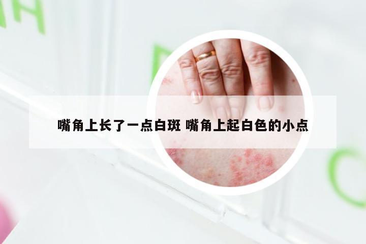 嘴角上长了一点白斑 嘴角上起白色的小点