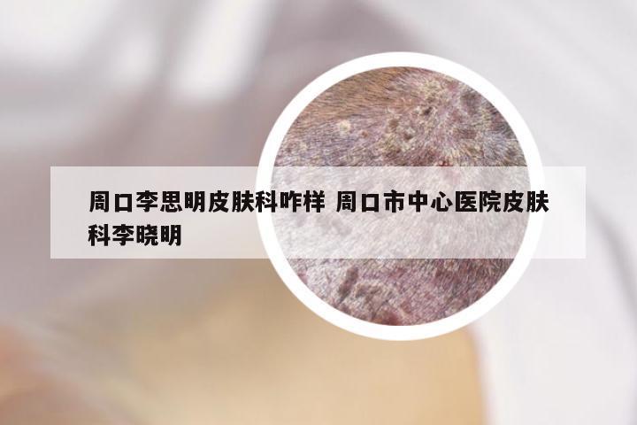 周口李思明皮肤科咋样 周口市中心医院皮肤科李晓明