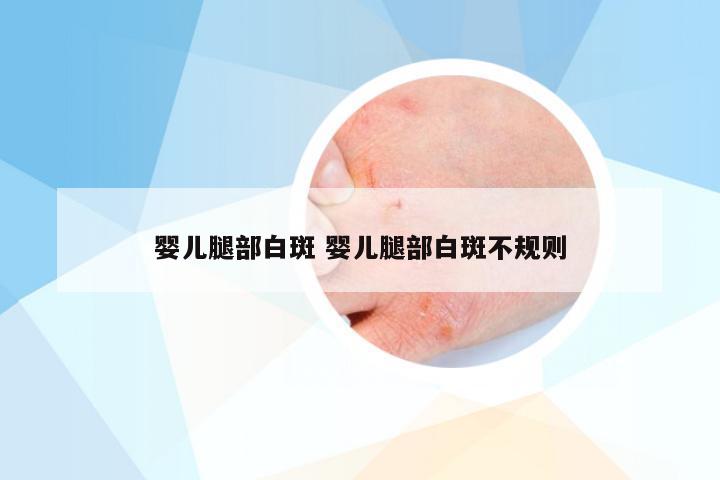 婴儿腿部白斑 婴儿腿部白斑不规则