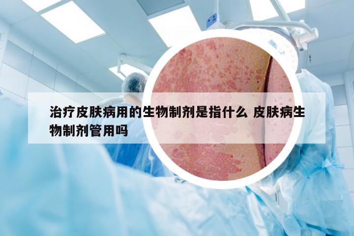 治疗皮肤病用的生物制剂是指什么 皮肤病生物制剂管用吗