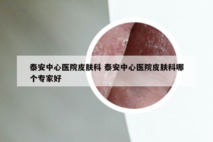 泰安中心医院皮肤科 泰安中心医院皮肤科哪个专家好