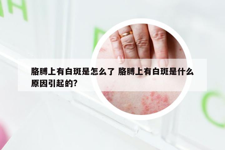 胳膊上有白斑是怎么了 胳膊上有白斑是什么原因引起的?