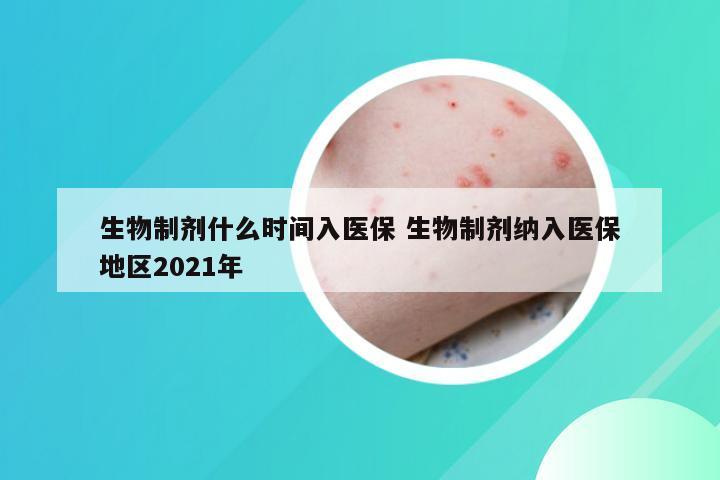 生物制剂什么时间入医保 生物制剂纳入医保地区2021年