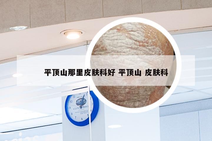 平顶山那里皮肤科好 平顶山 皮肤科