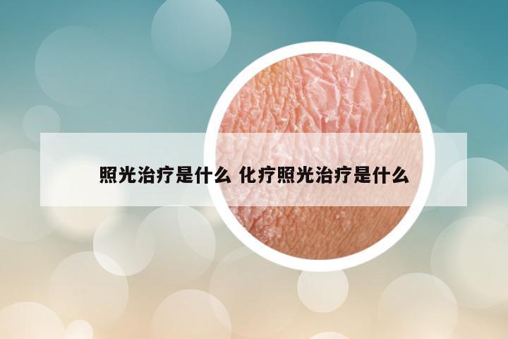 照光治疗是什么 化疗照光治疗是什么