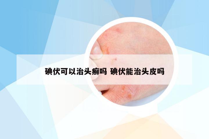 碘伏可以治头癣吗 碘伏能治头皮吗