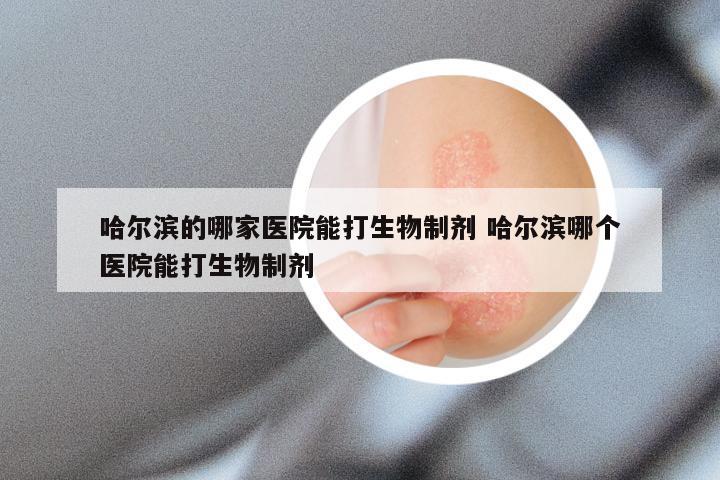 哈尔滨的哪家医院能打生物制剂 哈尔滨哪个医院能打生物制剂