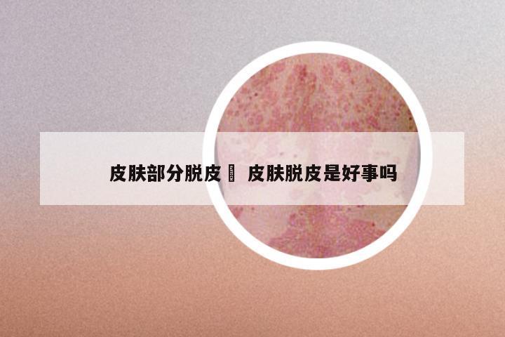 皮肤部分脱皮廯 皮肤脱皮是好事吗