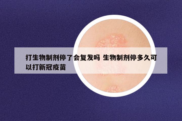打生物制剂停了会复发吗 生物制剂停多久可以打新冠疫苗