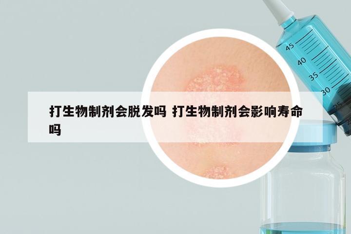 打生物制剂会脱发吗 打生物制剂会影响寿命吗