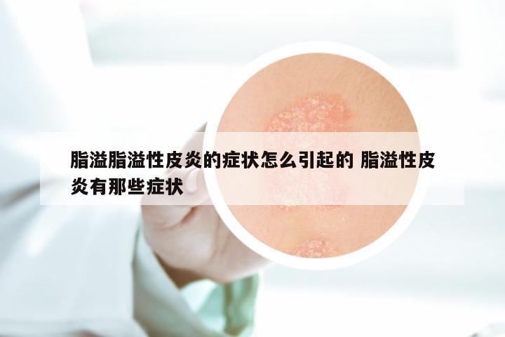 脂溢脂溢性皮炎的症状怎么引起的 脂溢性皮炎有那些症状